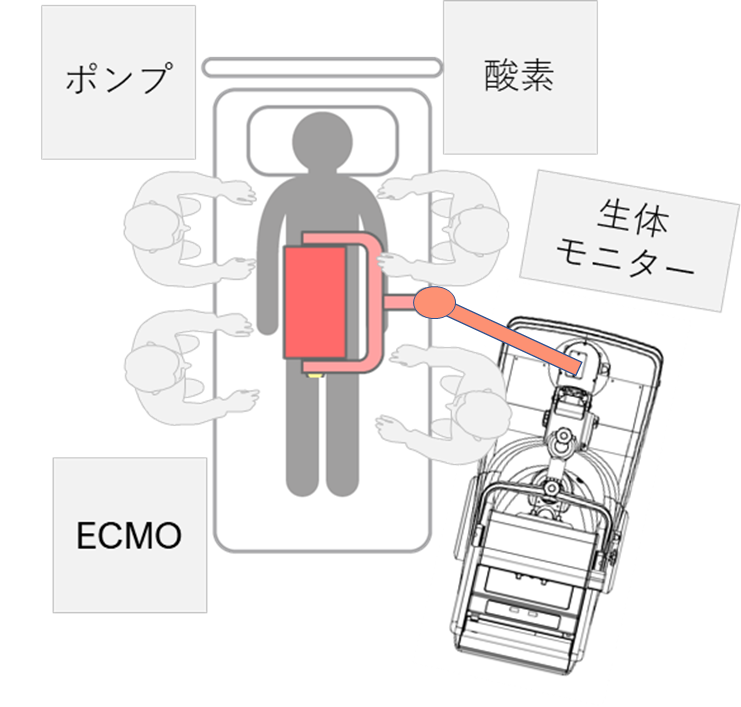 図 4　ECMO手技における器材と回診車の配置イメージ