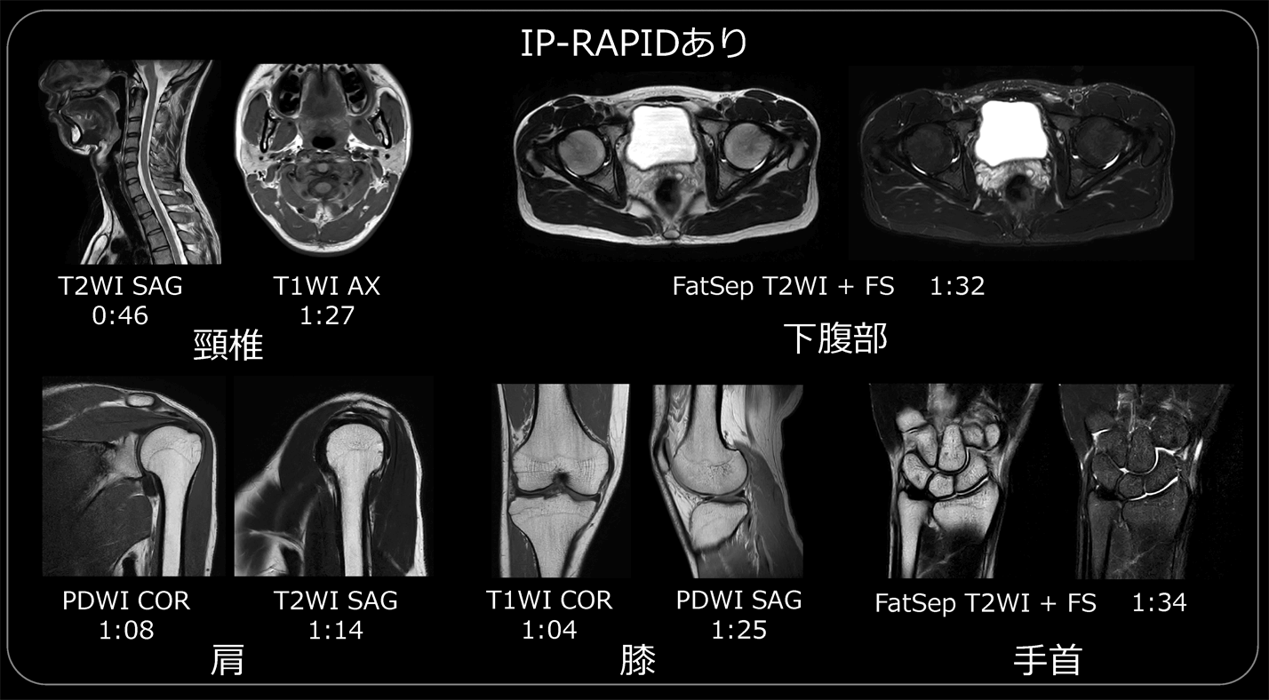 図５　頭部以外の部位にIP-RAPIDを適用した画像（磁場強度1.5T 超電導MRI）頭部だけでなく、さまざまな部位においても画質低下なく撮像時間を短縮できる。